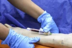 Estudiante realizando toma de muestras de sangre en el diplomado para auxiliar de enfermería